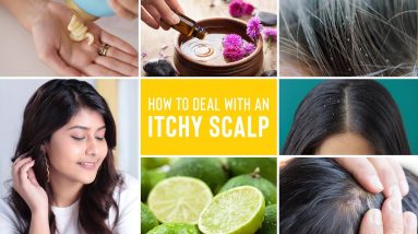 Itchy Scalp Treatments | Remedies For Dandruff, Lice and Scalp Acne 8 1681261672 maxresdefault
