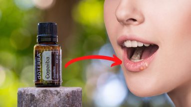 Copaiba: Powerful Remedy for Herpes, Eczema, Syphilis, and Even Stroke 16 1681265372 maxresdefault