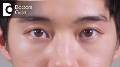 How to manage sudden swelling of the face especially near eye region? - Dr. Sunita Rana Agarwal 10 1681266944 maxresdefault