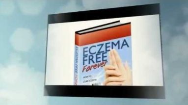 Best Creams For Eczema -- The Best Creams to Quickly Stop the Itching 20 1681267421 hqdefault