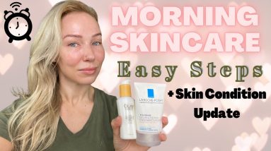 MY *UPDATED* MORNING SKINCARE ROUTINE OILY SKIN / Eczema awareness 2 1681269016 maxresdefault