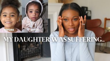 My Daughter Was Suffering For A Long Time:Treatment, Steroids & More 20 1681269511 maxresdefault