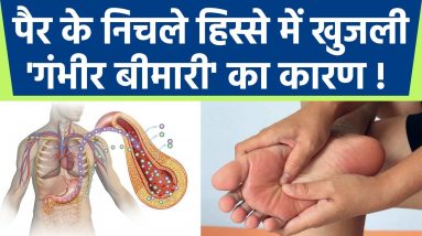 पैर के निचले हिस्से में खुजली होना Diabetes से लेकर Eczema का Symptoms, असली वजह क्या है | Boldsky 16 1681270695 maxresdefault
