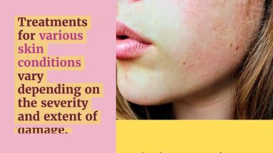 Why Dead Sea Salt is a Miracle Cure for Eczema 14 1681276539 maxresdefault