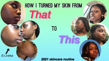 My 2021 Skincare Routine: How I got rid of Eczema on my face. 14 1681281011 maxresdefault