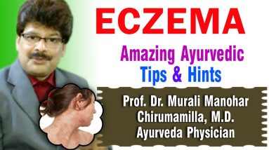 Eczema | Ayurvedic Remedies | Prof. Dr. Murali Manohar Chirumamilla, M.D. (Ayurveda) 6 1681294413 maxresdefault