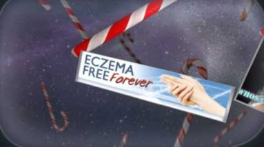 Creams For Eczema : 3 Best Over the Counter Creams For Eczema 4 1681297123 hqdefault