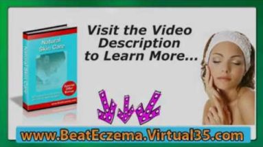 hand eczema treatment - eczema home treatment - eczema treatment 10 1681298537 hqdefault
