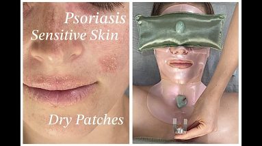 Extremely Dry Sensitive skin + Psoriasis Facial @TheBalancedBlonde | Jadeywadey180 4 1681299448 maxresdefault