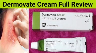 Dermovate Cream Review, Benefits, Side Effects, And Uses | Cream For Eczema 2 1681300792 maxresdefault