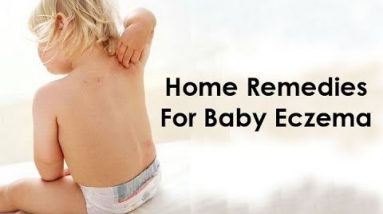 How to Cure Eczema for Babies - Eczema Home Treatment for Babies 20 1681301812 hqdefault