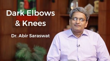 Skin Lightening Treatment For Dark Elbows & Knees | Dermatologist Dr. Abhir Saraswat | Skin Diaries 14 1681302599 maxresdefault