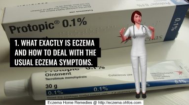 Eczema Laser Treatment Video 6 1681305508 maxresdefault
