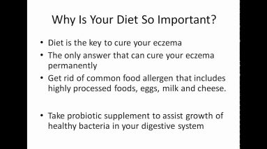 Eczema Home Remedies (Why It Works Better Than The Doctor?) 2 1681306154 maxresdefault