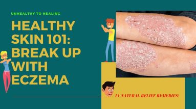 BREAK UP With Eczema (With These 11 Natural Relief Remedies) 12 1681309339 maxresdefault