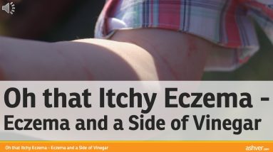 Eczema and a Side of Vinegar - Home Remedies without having to Spend Big Bucks 10 1681309700 maxresdefault