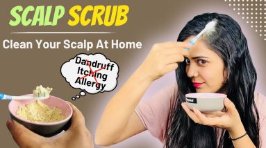 Scalp scrub : No Dandruff, No itching, No allergy | सिर की त्वचा को साफ़ करे #thesoni #haircare 6 1681310474 maxresdefault
