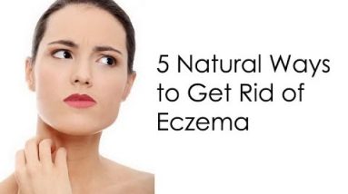 How to Get Rid of Eczema : 5 Natural Ways to Get Rid of Eczema 12 1681335632 hqdefault