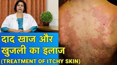 दाद खाज और खुजली का इलाज || Treatment of Itchy Skin 10 1681340862 maxresdefault
