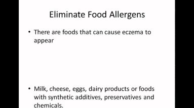 Eczema Lotion (Little Known Cream That Works Like A Charm) 16 1681349932 maxresdefault