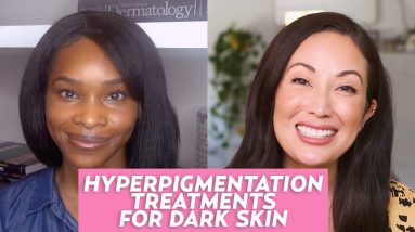 Hyperpigmentation in Dark Skin Tones: A Dermatologist Shares Skincare Tips & Treatments! 18 1681356786 maxresdefault