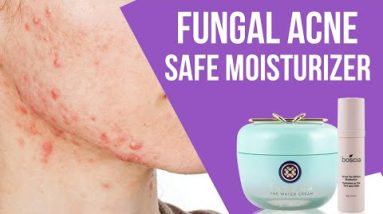 5 Best Fungal Acne Safe Moisturizer to Use on Fungal Acne Prone Skin 12 1681357380 hqdefault