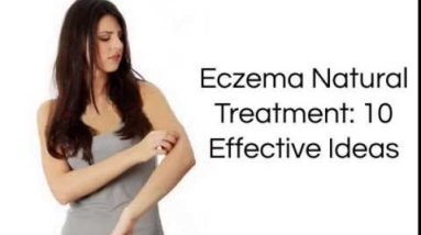 Eczema Natural Treatment : 10 Effective Ideas for Eczema Home Treatments 12 1681360711 hqdefault