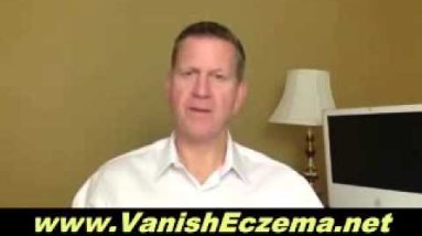 How to Effectively Use Your Eczema Rash Relief Cream 10 1681361040 hqdefault