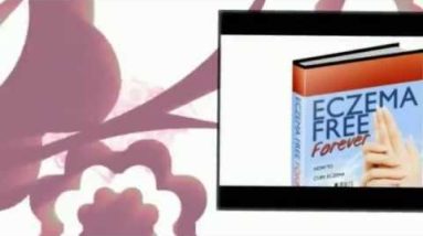 Shampoo For Eczema : Best Shampoo For Eczema and Body Wash 6 1681370127 hqdefault