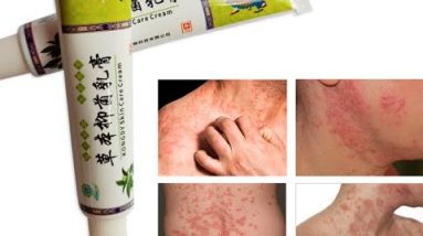 Ifory 3pcs Chinese Ointment Massage Psoriasis Eczema Cream Dermatitis Eczematoid Eczema Ointment 14 1681390834 hqdefault
