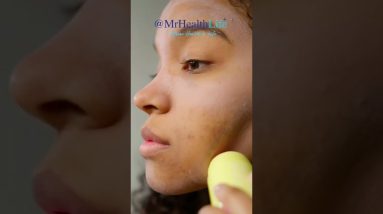 How to reduce Acne, Psoriasis and Eczema 6 1681408848 maxresdefault