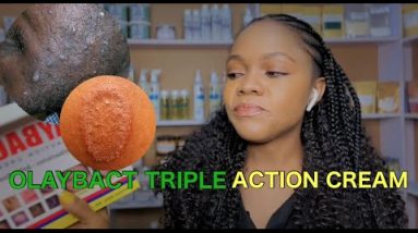 #olaybact #tripleactioncream #eczema OLAYBACT TRIPLE ACTION CREAM REVIEW / BEST SKIN TREATMENT 16 1681424396 hqdefault
