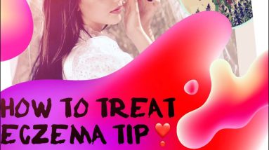 How to treat eczema | tip 1 14 1681431593 maxresdefault