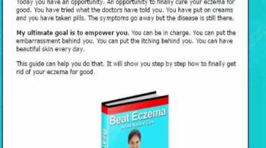 Eczema -eczema cream for babies - That's it! 10 1681435459 hqdefault