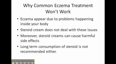 How To Use Eczema Diet To Treat Eczema (One Basic Tip That Works!) 20 1681454178 maxresdefault