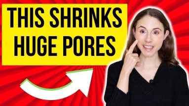 PORE SHRINKING TREATMENTS THAT ACTUALLY WORK 😍 Dermatologist @DrDrayzday 20 1681457476 maxresdefault