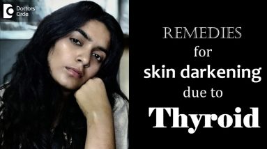 Can thyroid problems cause skin discoloration? Causes & Treatment - Dr. Rasya Dixit 14 1681468822 maxresdefault