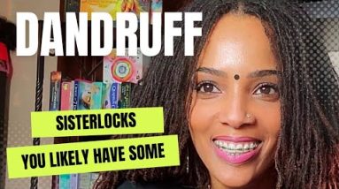 Dandruff, Dry Scalp, Dermatitis etc.| When You Have Locs YOU MUST know this!!! 4 1681487377 hqdefault