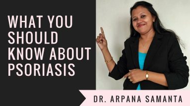 सोरायसिस चर्म रोग का उपचार इलाज के तरीके और दवाई || How To Treat Psoriasis 8 1681517347 maxresdefault