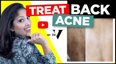 1681539332 maxresdefault