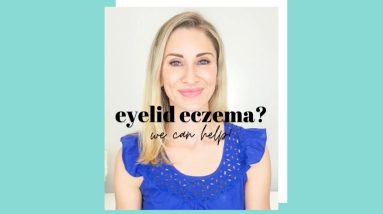 Eyelid Eczema? We can help! 18 1681607565 maxresdefault