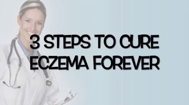 3 Steps To Get Rid Of Eczema Forever 16 1681613492 maxresdefault
