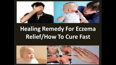 HOW TO CURE ECZEMA FAST/NATURAL REMEDY FOR ITCHY SKIN/ECZEMA INSTANT RELIEF/ECZEMA TREATMENT 8 1681628285 maxresdefault