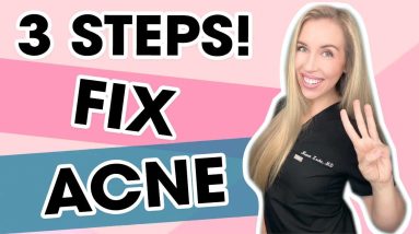 3 Steps To Fix Your Acne WITHOUT A Prescription | Skincare Made Simple by The Budget Dermatologist 2 1681639503 maxresdefault