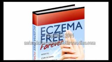 Homeopathic Eczema Treatment 20 1681643148 hqdefault