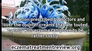 A Home Remedy For Eczema 18 1681646824 hqdefault