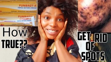 HOW TO USE: FUNBACT-A CREAM ,SPOT/ECZEMA/PIMPLES FREE 12 1681655500 maxresdefault