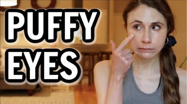 How to get rid of puffy eyes| Dr Dray 4 1681672634 maxresdefault