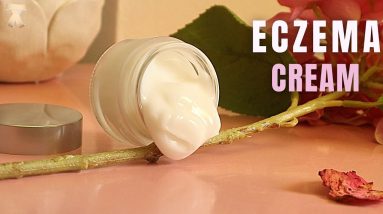 Homemade Body Cream For Eczema Itchy Skin Relief 20 1681677692 maxresdefault