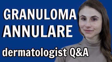 Granuloma annulare: treatments and causes: dermatologist Dr Dray 16 1681687385 maxresdefault